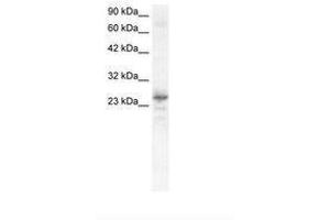 Image no. 1 for anti-NK2 Homeobox 8 (NKX2-8) (C-Term) antibody (ABIN6735828) (NKX2-8 Antikörper  (C-Term))