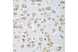Immunohistochemistry of paraffin-embedded mouse brain using EIF1AX antibody at dilution of 1:100 (40x lens). (EIF1AX Antikörper)