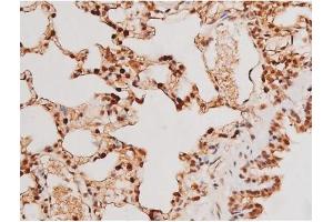 ABIN6267502 at 1/200 staining Rat lung tissue sections by IHC-P. (STAT3 Antikörper  (pTyr705))