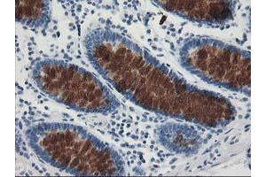 Immunohistochemical staining of paraffin-embedded Human colon tissue using anti-AP2M1 mouse monoclonal antibody. (AP2M1 Antikörper  (AA 97-383))