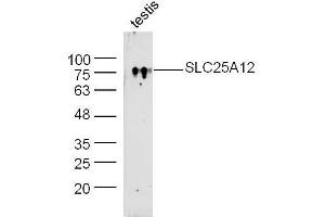 Mouse testis lysate probed with Rabbit Anti-SLC25A12/ARALAR Polyclonal Antibody, Unconjugated  at 1:300 overnight at 4˚C. (SLC25A12 Antikörper  (AA 101-200))