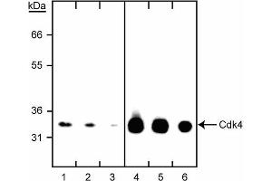 Western blot titration of anti-Cdk4 antibody. (CDK4 Antikörper)