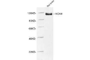 Western blot analysis of tissue lysates using 1 µg/mL Rabbit Anti-NCAM Polyclonal Antibody (ABIN398893) The signal was developed with IRDyeTM 800 Conjugated Goat Anti-Rabbit IgG. (CD56 Antikörper  (AA 780-830))