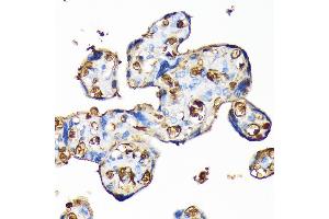 Immunohistochemistry (IHC) image for anti-Hemoglobin, alpha 1 (HBA1) antibody (ABIN7267608)