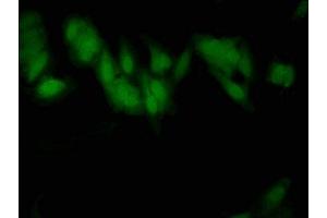 Immunofluorescence (IF) image for anti-Solute Carrier Family 2 (Facilitated Glucose Transporter), Member 4 (SLC2A4) (AA 223-287) antibody (ABIN7170123)