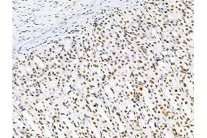 ABIN6256529 and ABIN6267184 at 1/100 staining Rat stomach tissue by IHC-P. (SQSTM1 Antikörper  (pSer272, pThr269))