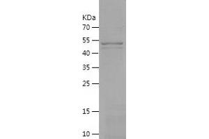 Western Blotting (WB) image for Tumor Necrosis Factor-Inducible Protein 6 (TNFAIP6) (AA 18-277) protein (His-IF2DI Tag) (ABIN7125558) (TNFAIP6 Protein (AA 18-277) (His-IF2DI Tag))