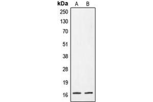 Western blot analysis of CRABP2 expression in A431 (A), HeLa (B) whole cell lysates.