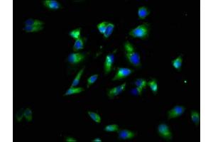 Immunofluorescence staining of Hela cells with ABIN7173883 at 1:60, counter-stained with DAPI. (LTBR Antikörper  (AA 31-224))