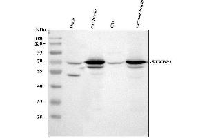 Western blot analysis of STXBP1 using anti-STXBP1 antibody (ABIN3043413).