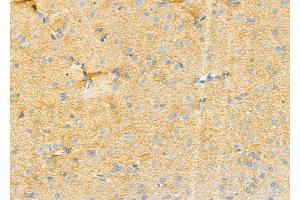 ABIN6258722 and ABIN6274757 at 1/100 staining Rat brain tissue by IHC-P. (RPS4Y1 Antikörper  (C-Term))