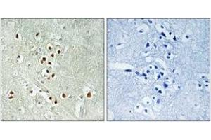 Immunohistochemistry (IHC) image for anti-Growth Arrest and DNA-Damage-Inducible, gamma Interacting Protein 1 (GADD45GIP1) (AA 91-140) antibody (ABIN1534947)