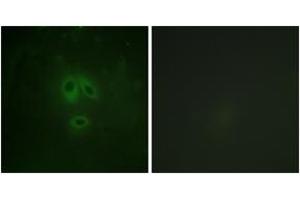 Immunofluorescence analysis of HeLa cells, using n-NOS (Phospho-Ser852) Antibody. (NOS1 Antikörper  (pSer852))