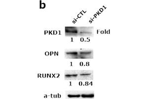 Western Blotting (WB) image for anti-Runt-Related Transcription Factor 2 (RUNX2) (AA 242-521) antibody (ABIN3016834)