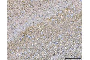IHC analysis of YWHAE using anti-YWHAE antibody (ABIN7600163).