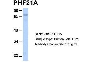 Host:  Rabbit  Target Name:  PHF21A  Sample Type:  Human Fetal Lung  Antibody Dilution:  1. (PHF21A Antikörper  (N-Term))