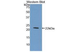 Western Blotting (WB) image for anti-Myeloproliferative Leukemia Virus Oncogene (MPL) (AA 311-460) antibody (ABIN1859873) (MPL Antikörper  (AA 311-460))