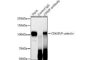 Immunoprecipitation analysis of 600 μg extracts of Mouse spleen cells using 3 μg CD62P/P-selectin antibody (ABIN7270190). (P-Selectin Antikörper)