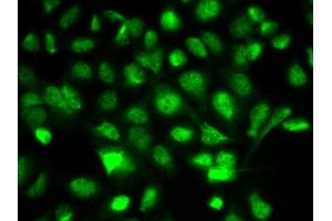 Immunofluorescence analysis of A549 cells using BIRC2 antibody. (BIRC2 Antikörper  (AA 1-300))