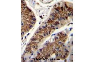Immunohistochemistry (Paraffin-embedded Sections) (IHC (p)) image for anti-Inhibin, beta A (INHBA) (AA 92-119), (N-Term) antibody (ABIN952902)