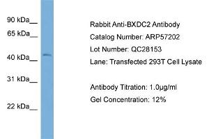 WB Suggested Anti-BXDC2  Antibody Titration: 0. (BRIX1 Antikörper  (Middle Region))