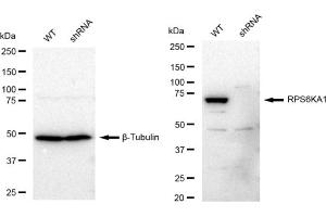 Western blotting analysis using RPS6KA1 antibody (ABIN7800229). (Rekombinanter RPS6KA1 Antikörper)