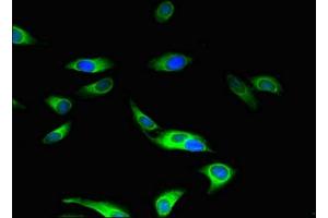 Immunofluorescent analysis of Hela cells using ABIN7160045 at dilution of 1:100 and Alexa Fluor 488-congugated AffiniPure Goat Anti-Rabbit IgG(H+L) (ASK1 Antikörper  (AA 363-431))