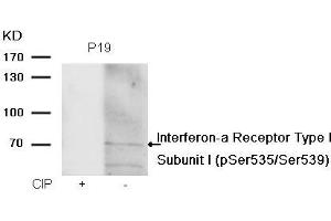 Western blot analysis of extracts from P19 cells, treated with calf intestinal phosphatase (CIP), using Interferon-a Receptor Type I Subunit I (phospho-Ser535/Ser539) Antibody. (IFNAR1 Antikörper  (pSer535, pSer539))