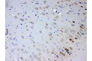 IHC testing of FFPE rat brain tissue with IL15RA antibody at 1ug/ml. (IL15RA Antikörper)