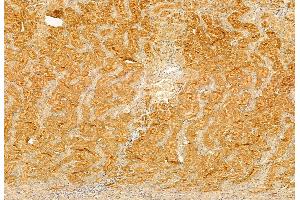 ABIN6260212 and ABIN6272874 at 1/100 staining Rat kidney tissue by IHC-P. (BBS5 Antikörper  (C-Term))