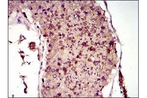Immunohistochemical analysis of paraffin-embedded testis tissues using MAP1LC3A mouse mAb with DAB staining. (MAP1LC3A Antikörper  (AA 1-121))