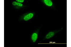 Immunofluorescence of monoclonal antibody to CARF on HeLa cell. (CDKN2AIP Antikörper  (AA 1-579))