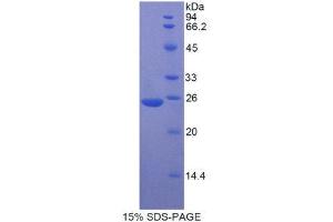 SDS-PAGE (SDS) image for Myosin Heavy Chain 8, Skeletal Muscle, Perinatal (MYH8) (AA 40-240) protein (His tag) (ABIN1877794) (MYH8 Protein (AA 40-240) (His tag))