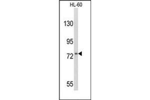 Western blot analysis of CD114 / CSF3R Antibody (Center) in HL-60 cell line lysates (35ug/lane). (CSF3R Antikörper  (Middle Region))
