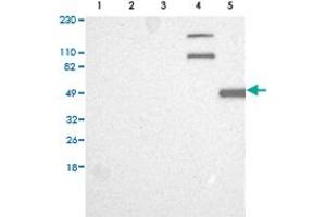Western Blot analysis of (1) Human RT-4 cell, (2) Human U-251MG sp cell, (3) Human A-431 cell, (4) Human liver tissue, (5) Human tonsil tissue. (CAPN10 Antikörper)