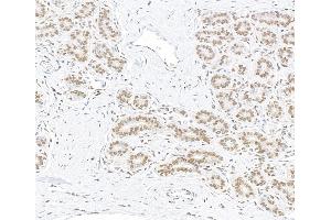 Immunohistochemistry (IHC) image for anti-AT Rich Interactive Domain 1B (SWI1-Like) (ARID1B) (AA 1425-1475) antibody (ABIN7795694) (Rekombinanter ARID1B Antikörper  (AA 1425-1475))