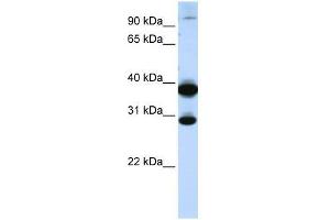 Western Blot showing ZNF138 antibody used at a concentration of 1-2 ug/ml to detect its target protein. (ZNF138 Antikörper  (C-Term))
