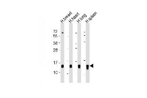 All lanes : Anti-S100A9 Antibody (Center) at 1:500-1:1000 dilution Lane 1: human breast lysate Lane 2: human heart lysate Lane 3: human lung lysate Lane 4: human spleen lysate Lysates/proteins at 20 μg per lane. (S100A9 Antikörper  (AA 22-56))