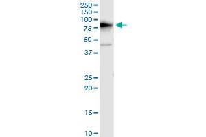 DDX3Y monoclonal antibody (M01), clone 2D7. (DDX3Y Antikörper  (AA 1-80))