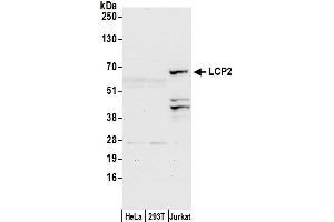 Western Blotting (WB) image for anti-Lymphocyte Cytosolic Protein 2 (SH2 Domain Containing Leukocyte Protein of 76kDa) (LCP2) (AA 200-250) antibody (ABIN7450409)