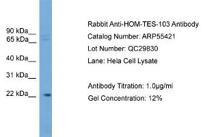 WB Suggested Anti-HOM-TES-103  Antibody Titration: 0. (IFFO1 Antikörper  (C-Term))