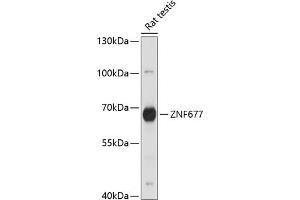 Western blot analysis of extracts of rat testis, using ZNF677 antibody (ABIN7271518) at 1:1000 dilution. (ZNF677 Antikörper  (AA 50-200))