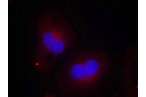Immunofluorescence staining of methanol-fixed Hela cells using FAK(Phospho-Tyr925) Antibody. (FAK Antikörper  (pTyr925))