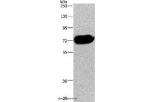 Western blot analysis of Human pancreas tissue, using CDC16 Polyclonal Antibody at dilution of 1:250 (CDC16 Antikörper)