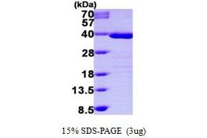 SDS-PAGE (SDS) image for Tropomyosin 1 (Alpha) (TPM1) (AA 1-284) protein (His tag) (ABIN667191) (Tropomyosin Protein (AA 1-284) (His tag))
