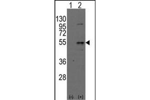 Western blot analysis of Dtnbpt(arrow) using rabbit polyclonal Dysbindin(Dtnbp1) Antibody (N-term) (ABIN389169 and ABIN2839335). (DTNBP1 Antikörper  (N-Term))