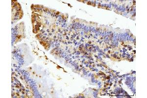 IHC analysis of BZW2 using anti-BZW2 antibody (ABIN7600608).