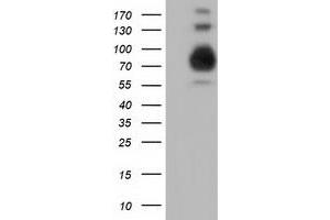 Western Blotting (WB) image for anti-phosphoinositide-3-Kinase Adaptor Protein 1 (PIK3AP1) antibody (ABIN1496827) (PIK3AP1 Antikörper)