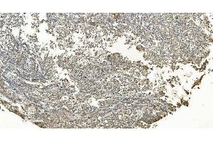 IHC analysis of FLCN using anti-FLCN antibody (ABIN7602491).