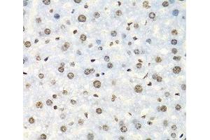 Immunohistochemistry of paraffin-embedded Mouse liver using IGF2BP2 Polyclonal Antibody at dilution of 1:100 (40x lens). (IGF2BP2 Antikörper)